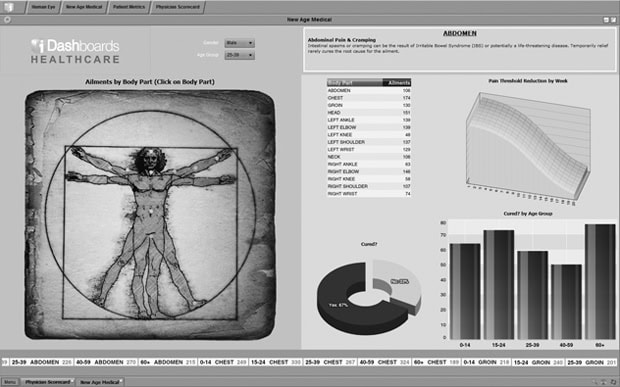The picture worth a thousand spreadsheet cells
